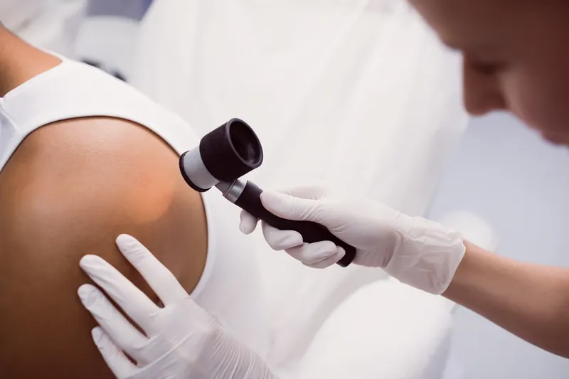 Examen d’un grain de beauté au dermatoscope en cabinet de dermatologie